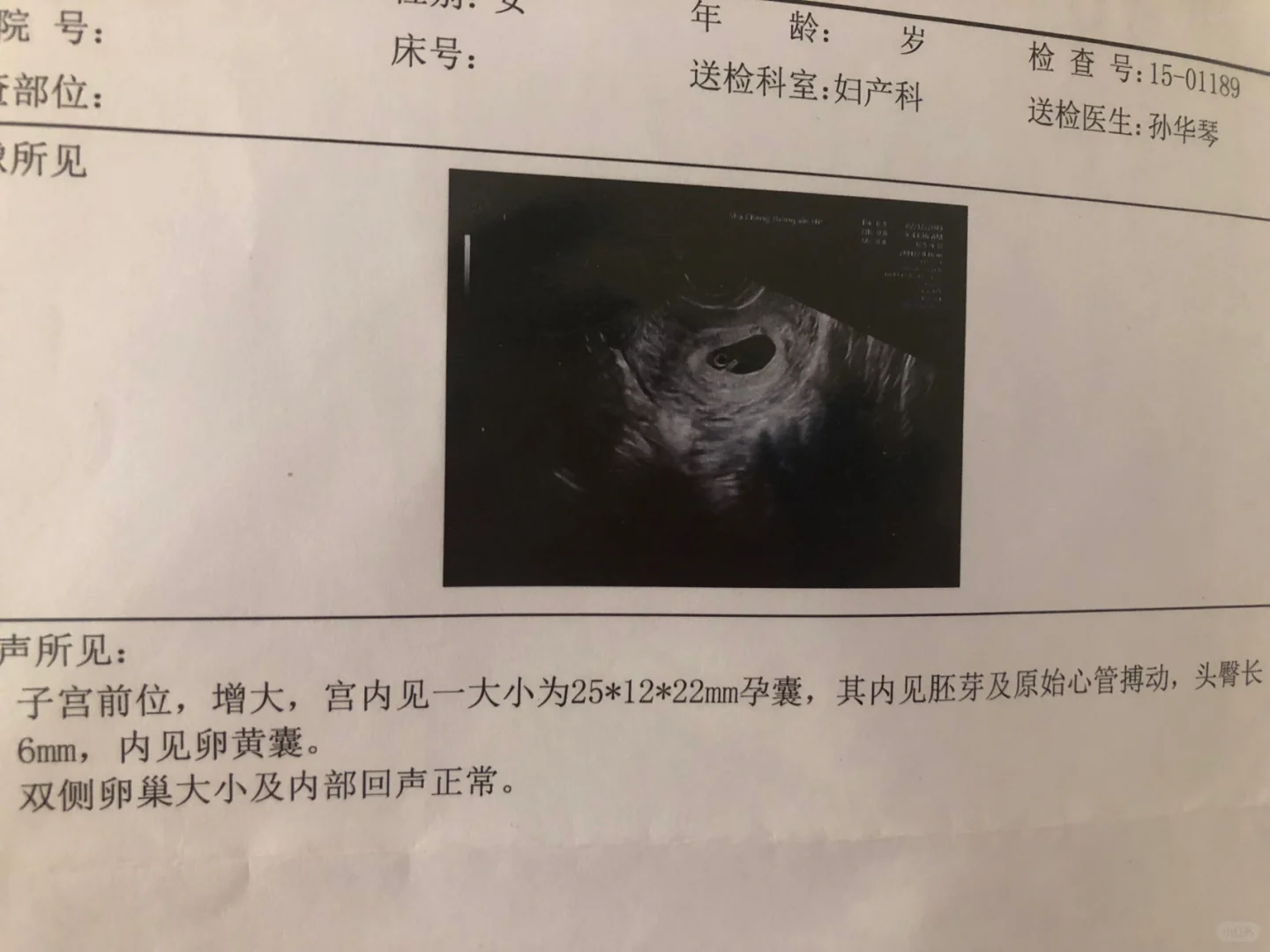 孕期症状数据看男女，你被坑了嘛？,坤和代孕怎么找